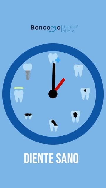 Publicación de Instagram de Bencomo Dental Clinic
